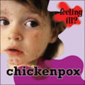 CHICKENPOX