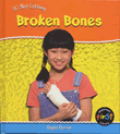 BROKEN BONES