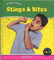 STINGS AND BITES