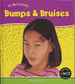 BUMPS AND BRUISES