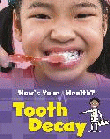 TOOTH DECAY