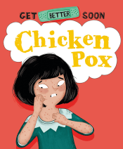 CHICKEN POX