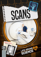 SCANS