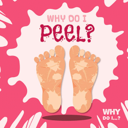 WHY DO I PEEL?