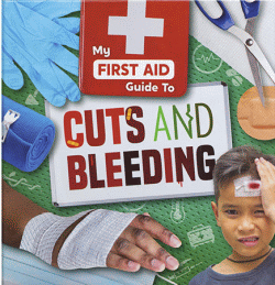 CUTS AND BLEEDING