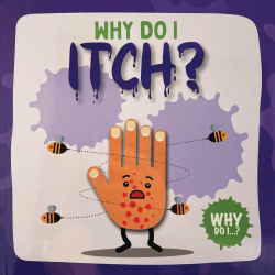 WHY DO I ITCH?
