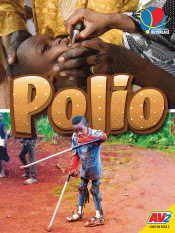 POLIO